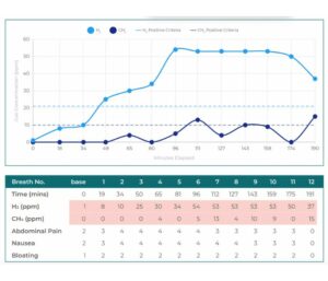 SIBO IBS Test